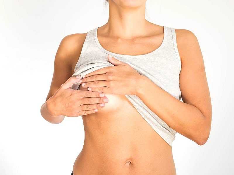 Сильна пітливість у жінок під грудьми: як позбутися червоних плям